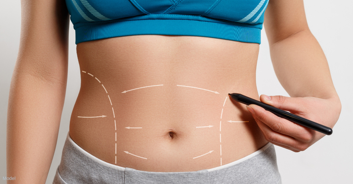 4 Types Of Liposuction: Allow Your Body The Opportunity To Look